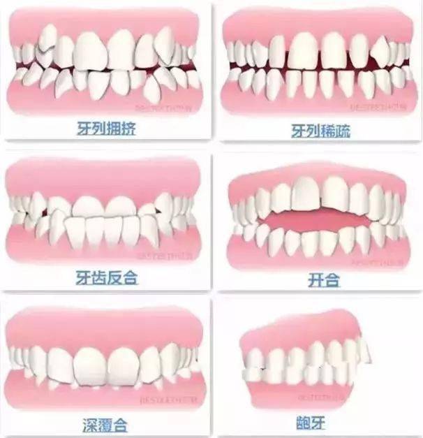 科技重塑自信微笑，最新矫治器引领潮流